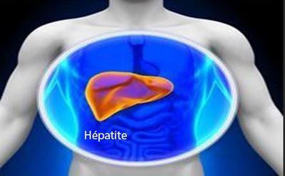 235- Vivre avec une Hépatite B Chronique : Hépatite B et Conduite à Tenir