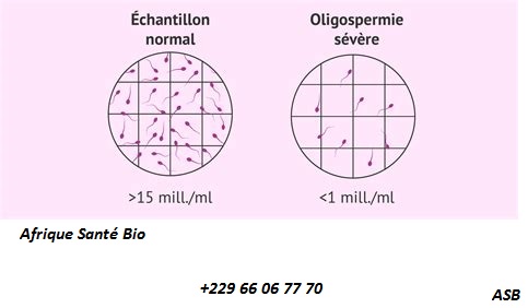 Qu’est-ce que l’oligospermie?
