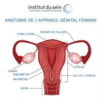 Traitement dystrophie ovarienne polykystique