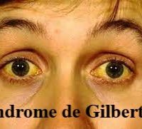 Soigner Naturellement Syndrome de Gilbert