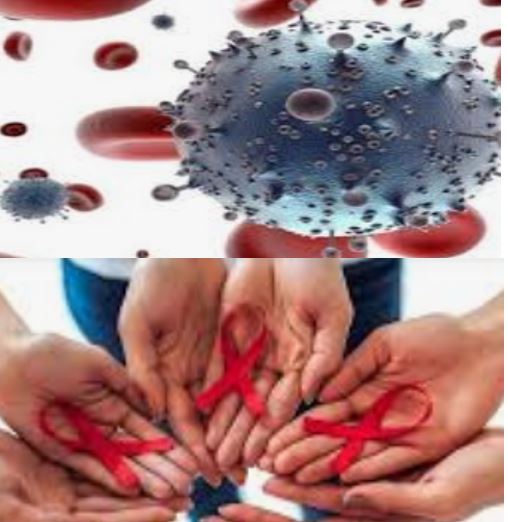 VIH/SIDA : De l'Infection par le VIH au SIDA Tout Savoir sur le SIDA