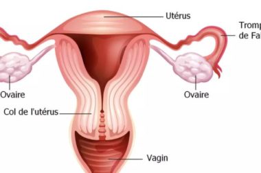 301- Salpingite Hydrosalpinx Traitement Naturel Salpingite