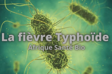 143-Comment Traiter la Fièvre Typhoïde Naturellement? Tout savoir