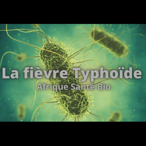 143-Comment Traiter la Fièvre Typhoïde Naturellement? Tout savoir