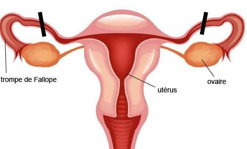 20 Remèdes Naturels Pour Déboucher les Trompes
