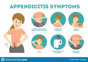 Symptômes Tout Savoir sur l'appendicite les astuces 
