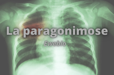 248-Avoir des Informations sur La Paragonimose: Explications et Diagnostic