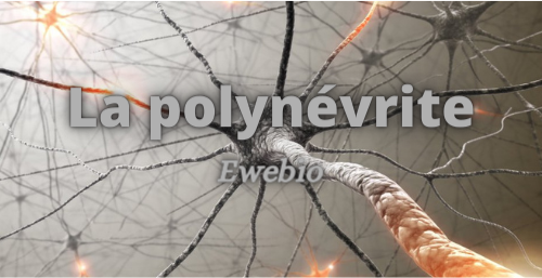 La polynévrite, qu'est-ce que c'est ?