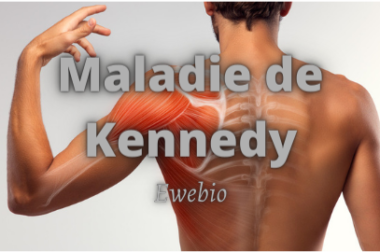 236-Connaître La Maladie de Kennedy: Traitement et Prise en Charge