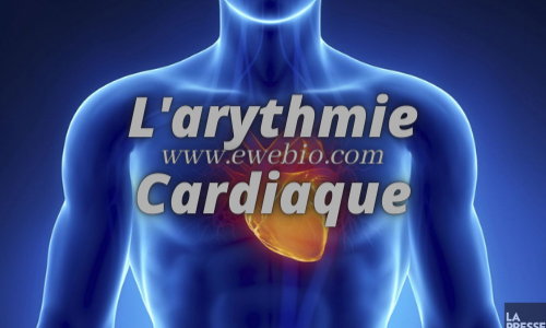 L'arythmie Cardiaque