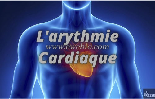 L'arythmie Cardiaque