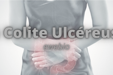 246- Qu’est-ce que la colite ulcéreuse? Connaître La Colite Ulcéreuse et Traiter