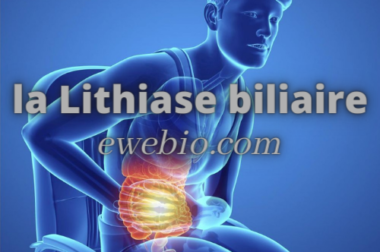 146-Comment Traiter la Lithiase Biliaire avec Plantes? Astuces et Solutions