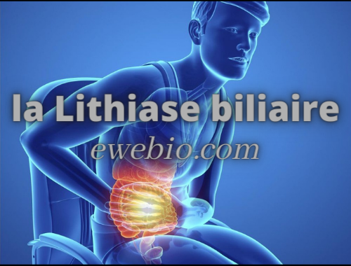 Comment Traiter la Lithiase Biliaire avec Plantes Astuces et Solutions
