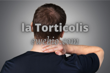148-C’est quoi le Torticolis ? Connaître Le Torticolis et Soigner Définitivement.