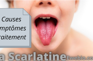 270-Remède Naturelle pour La Scarlatine : Causes, Symptômes, et Prévention