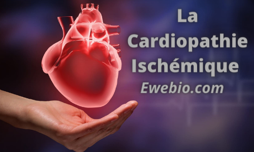 La Solution pour Soigner La cardiopathie ischémique