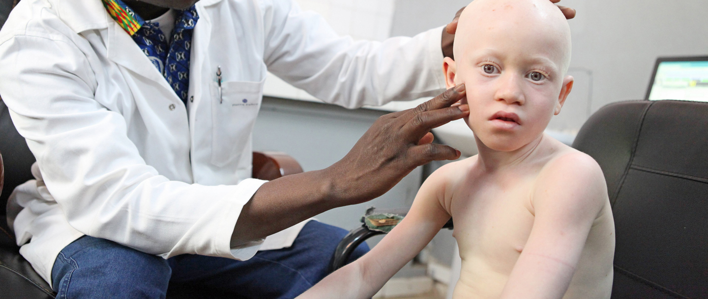 Connaître L'albinisme et Soigner