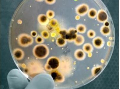 Fièvre Typhoïde et Paratyphoïde : Comment Soigner la Fièvre Typhoïde