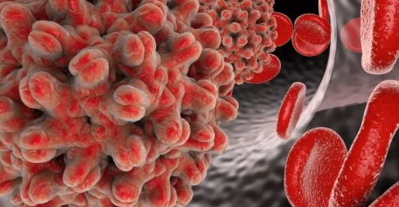 L'aménorrhée Traitement Naturel