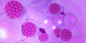 Comment Soigner l'infection liée au Papillomavirus?