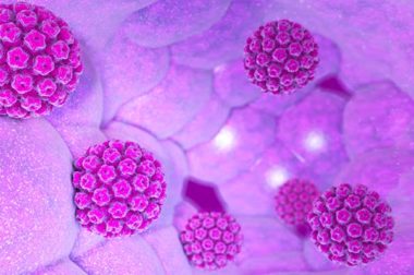 349- Condylomes : Comment Soigner l&rsquo;infection liée au Papillomavirus?