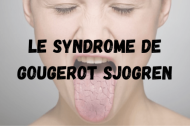 500-Syndrome de Gougerot Sjogren Définition Causes Symptômes Traitement