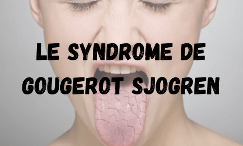 Soigner Naturellement le Syndrome de Gougerot Sjogren