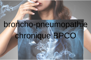 404- La broncho-pneumopathie chronique obstructive (BPCO) Symptômes et Traitements