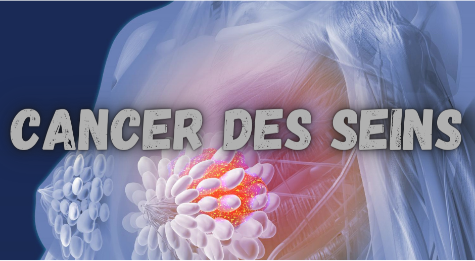 Comment soigner le Cancer des seins?