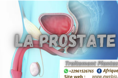 520- La Prostatite : Trouver les Causes et Symptômes pour Soigner