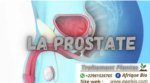 520- La Prostatite : Trouver les Causes et Symptômes pour Soigner