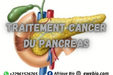 527- Cancer du Pancréas : Comment Soigner avec la Médecine Traditionnelle?