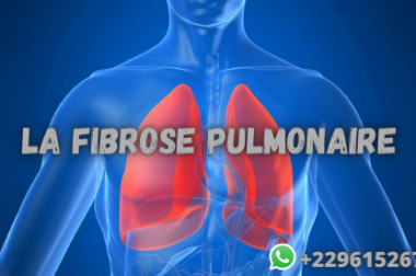 565- Peut-on Soigner La fibrose pulmonaire avec les Plantes D’Afrique?